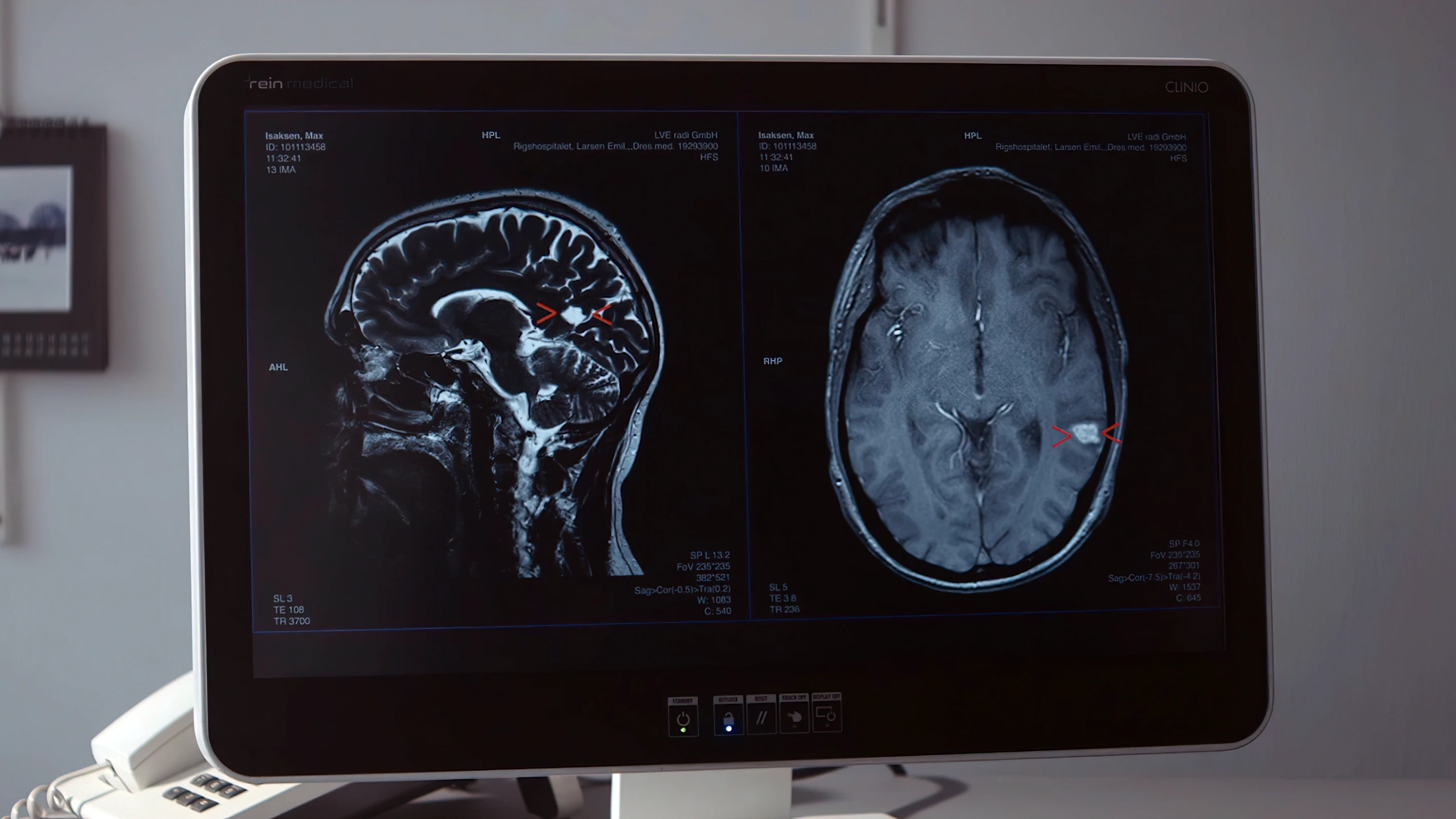 Кадр из фильма Йонаса Александра Арнбю «Отель для самоубийц», Злокачественная опухоль мозга, Exit Plan